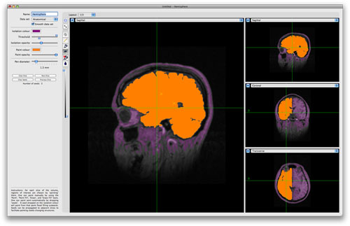 Brainsight_ROIHemisphere