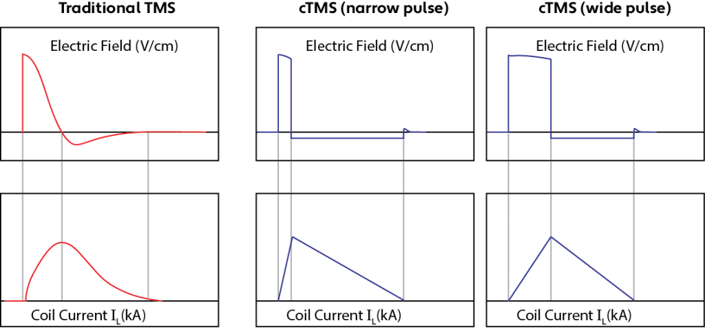 TMS_Waveforms